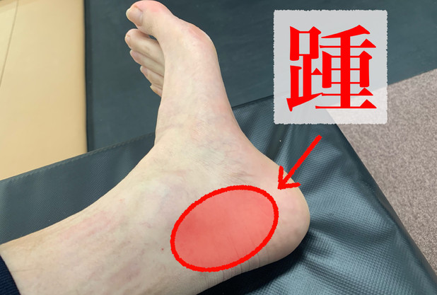 テニスと後脛骨筋①