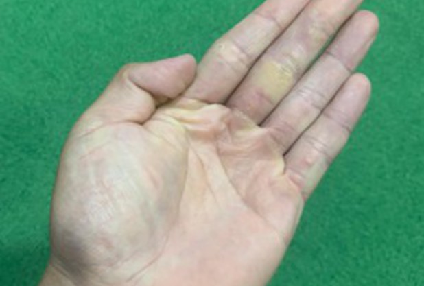 手の動きの種類